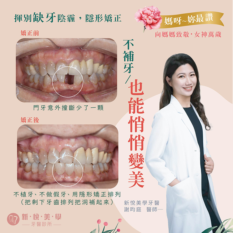 新悅美學牙醫診所的案例分享圖片